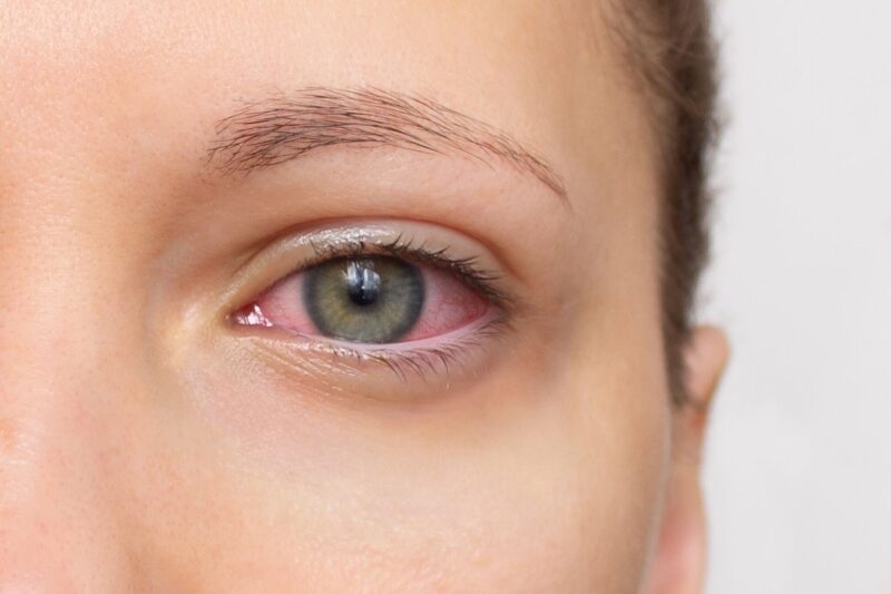 Oeil sec